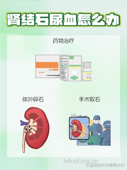 肾结石血尿怎么治疗
