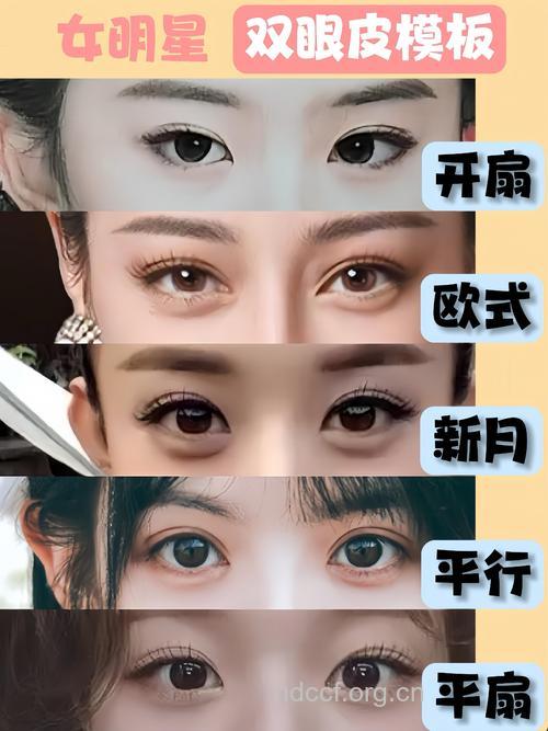 眼睛小能不能开眼角 哪些人适合呢