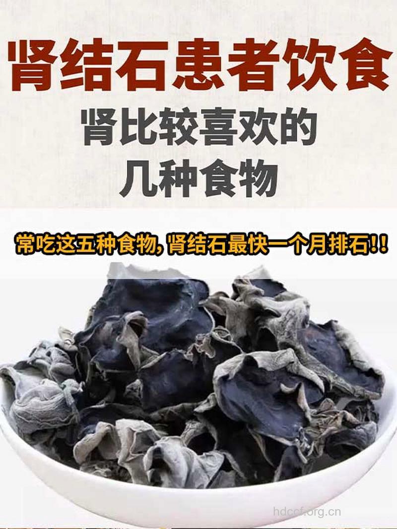 多吃黑木耳可帮助肾结石排石