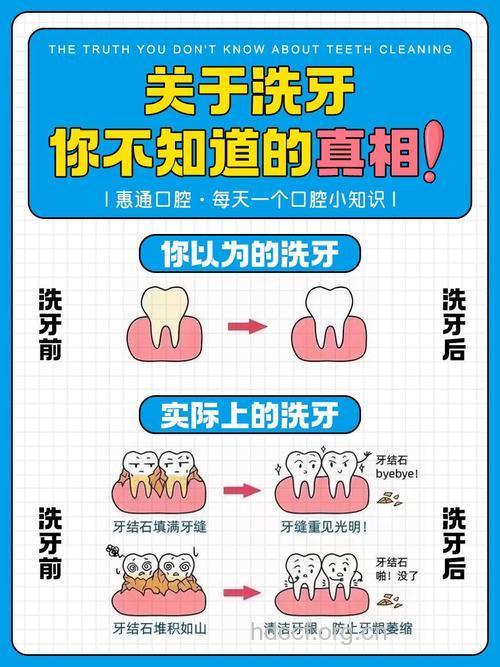 洗牙会不会损害到牙齿?