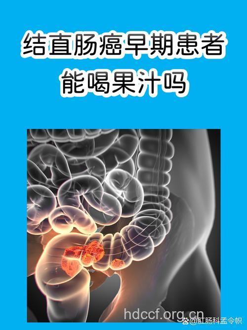喝果汁易得直肠癌