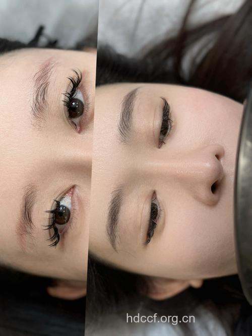 眉毛也能整 眉毛改型方式有哪些