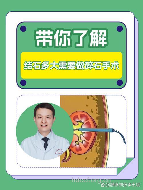 结石多大才需要碎石