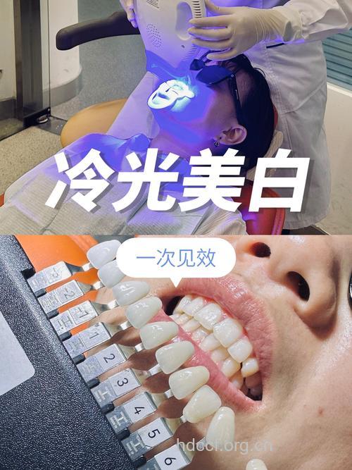 冷光美白牙齿的术后护理
