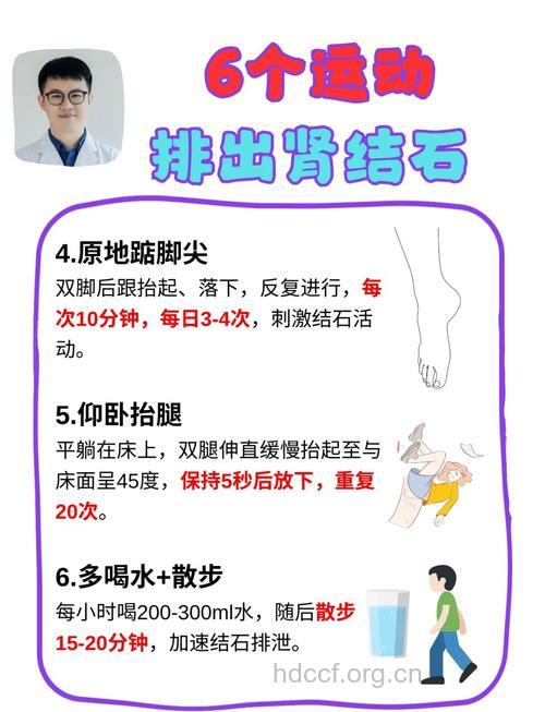 肾结石患者排石的妙招