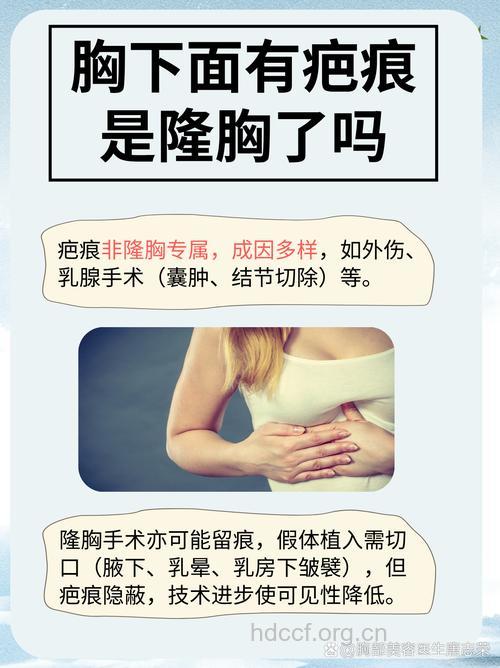 假体隆胸会影响乳腺吗 会留下疤痕吗
