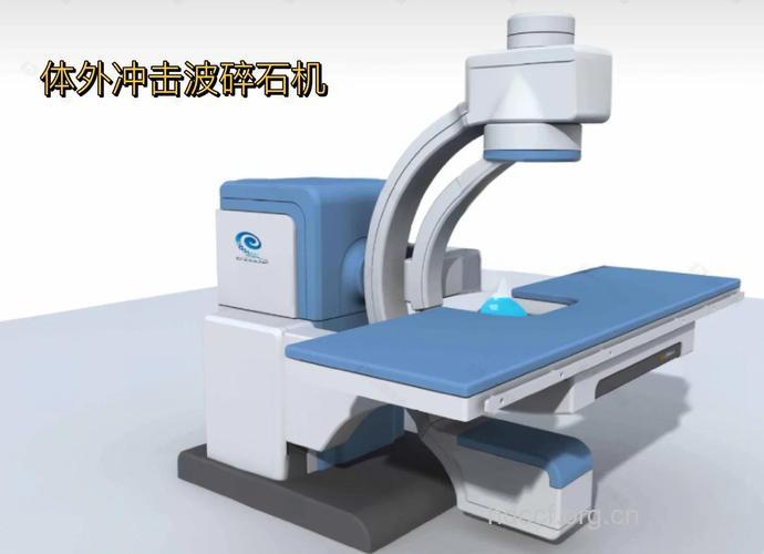 体外冲击波碎石效果好吗