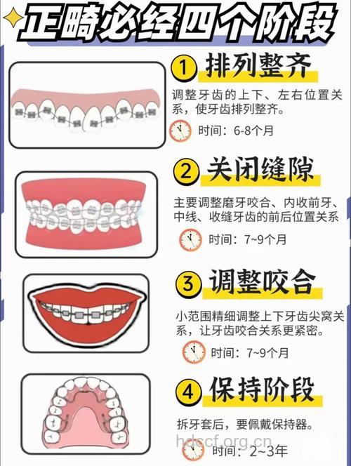 6大人群需要做牙齿矫正 如何矫正