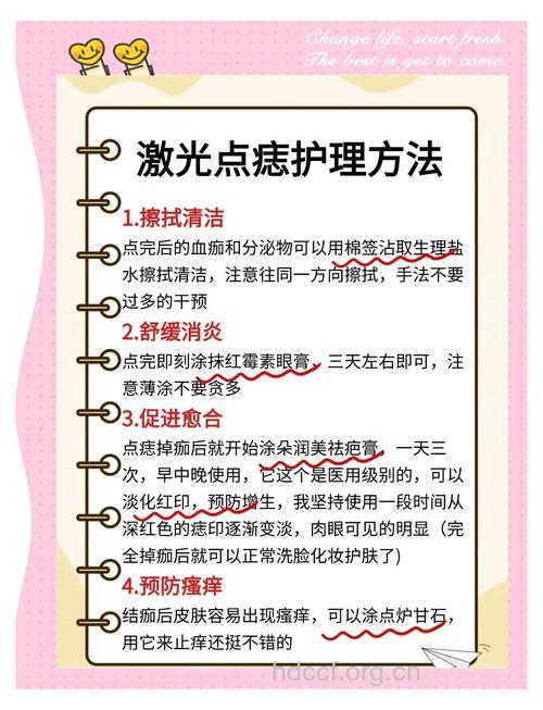 关于激光去痣你了解多少？