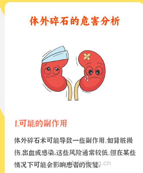 碎石术有哪何并发症