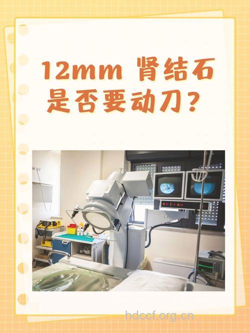 肾结石一定要动刀吗？