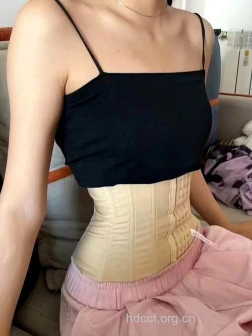腰部吸脂 重塑女性迷人腰身