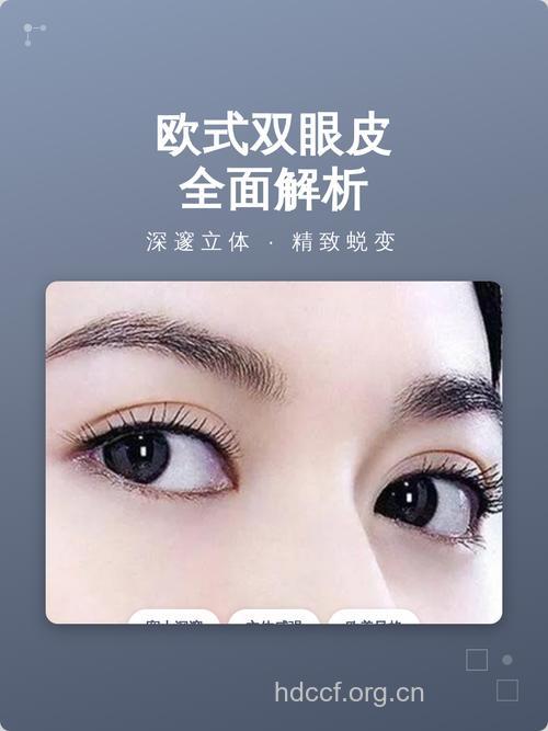 欧式双眼皮美翻了 你适合做吗