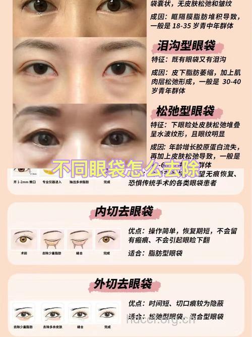 这些人不适合祛眼袋