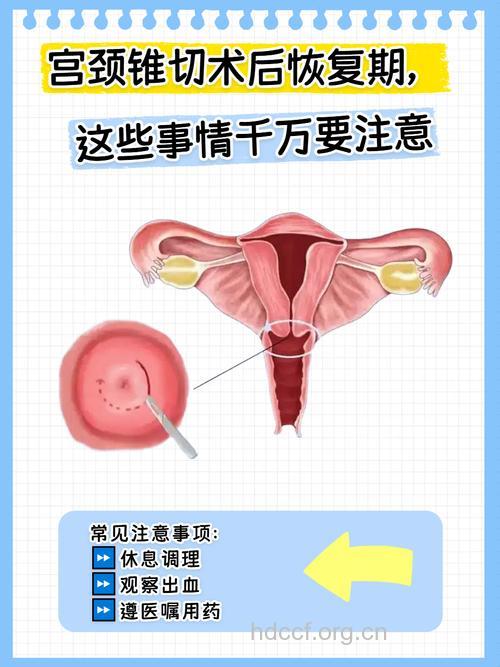 妇科整形手术的特点及注意事项