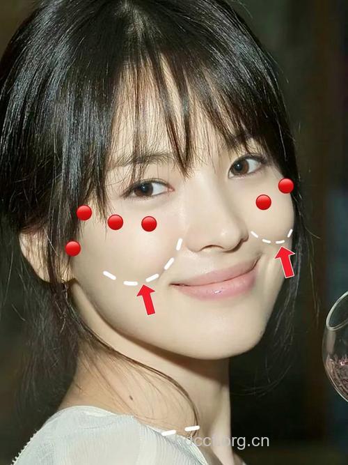 想要年轻 苹果肌减龄无压力