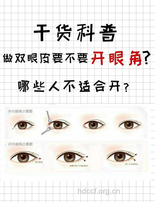 开眼角手术要注意六件事