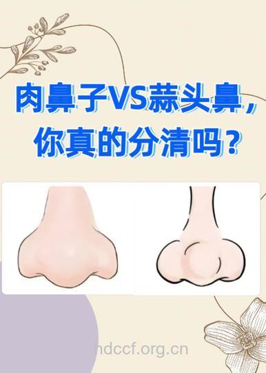 隆鼻的五大传言 你能辨别真假吗