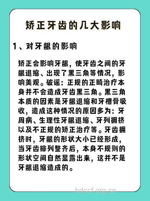 牙齿矫正有危害？修正两大错误认识