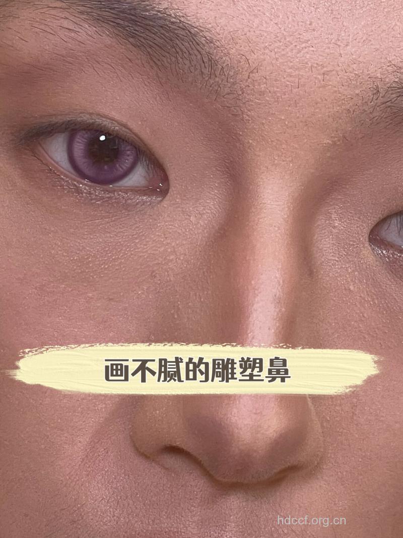 鼻头雕塑整形方法及注意事项