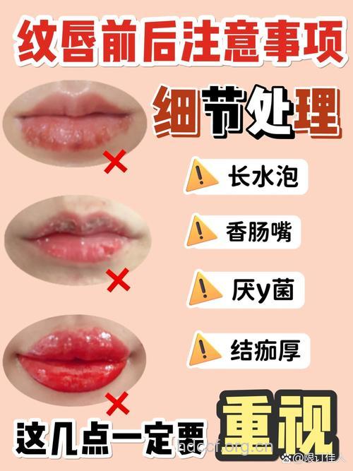 8招教你消除纹唇带来的肿胀