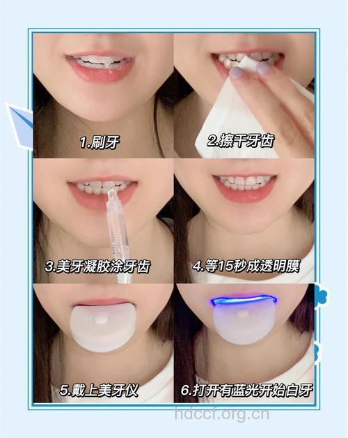 白领美白牙齿的五种方法