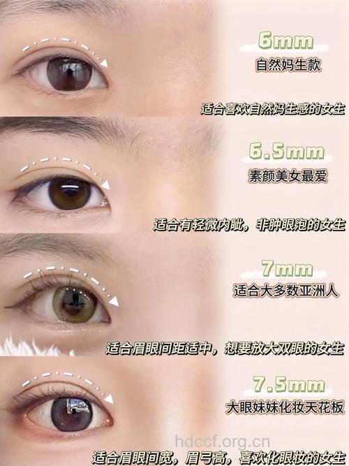 5个标准判断割双眼皮是否成功