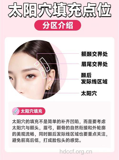 丰太阳穴的相关知识