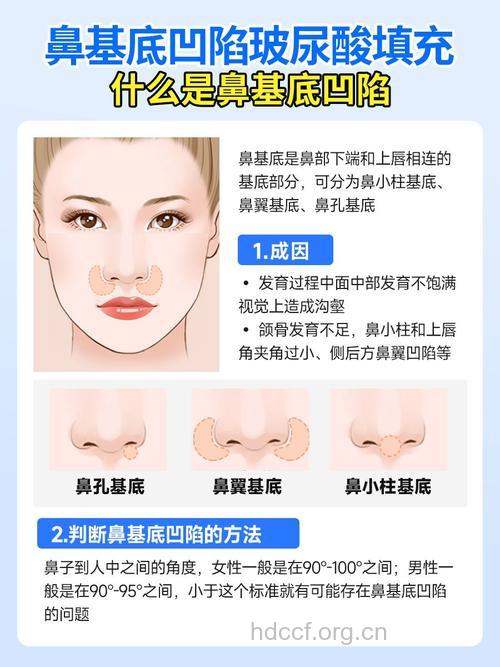 玻尿酸隆鼻需要注意哪些问题