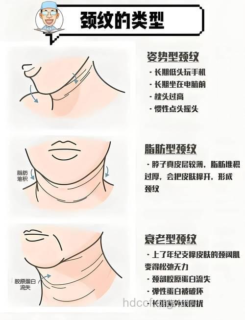 面颈部除皱的详细方法