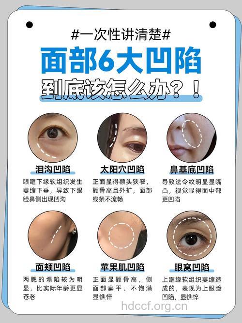 做面部整形后的6大注意