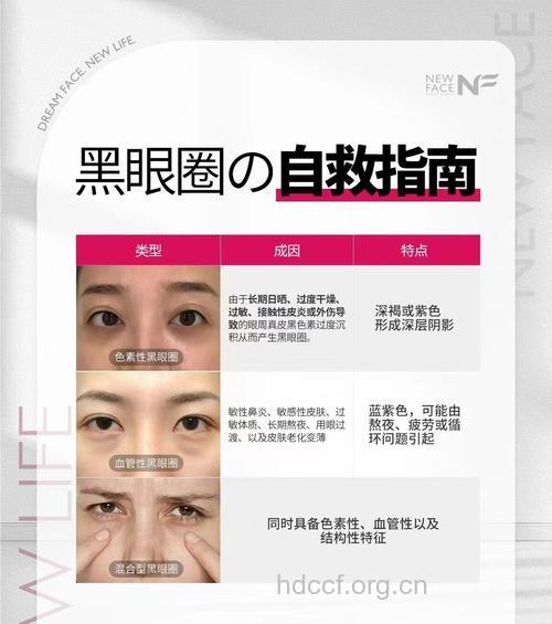 整形可以祛除各种黑眼圈?