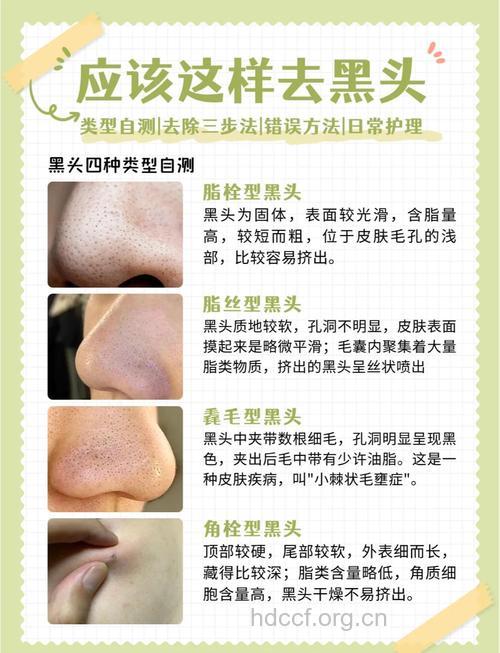 不能相信的祛黑头偏方