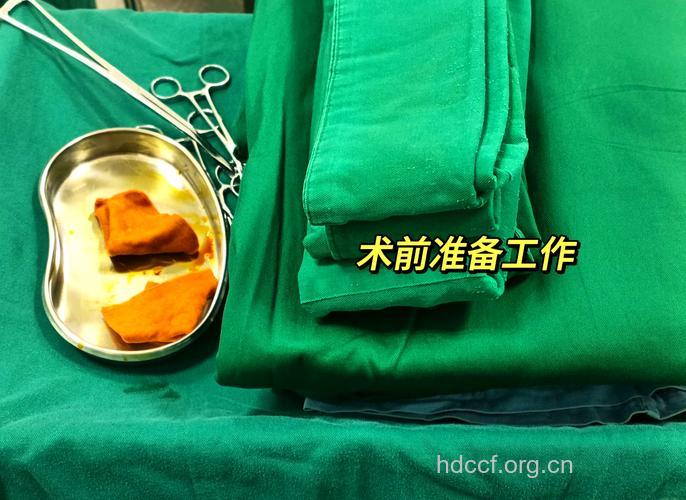 削骨瘦脸手术前准备