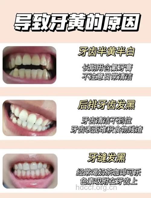 明星级牙齿美白小妙招