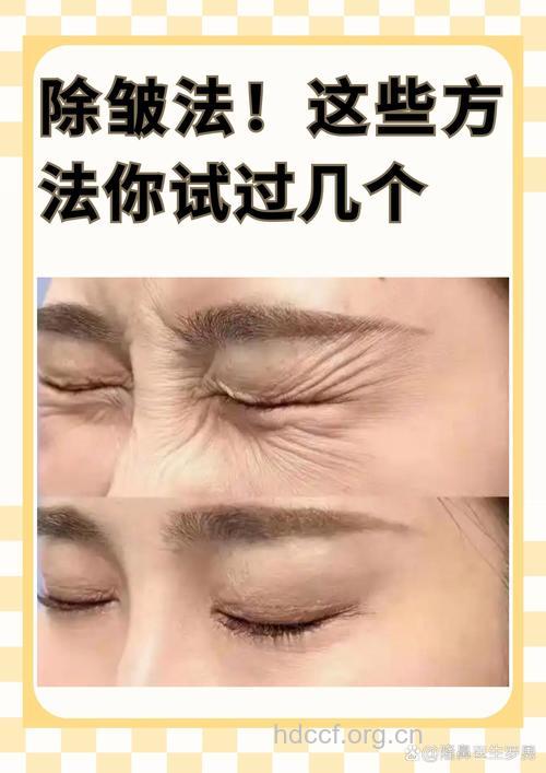 除皱整形有哪几种方式?