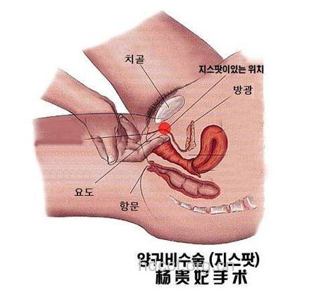 女性做生殖整形需谨慎