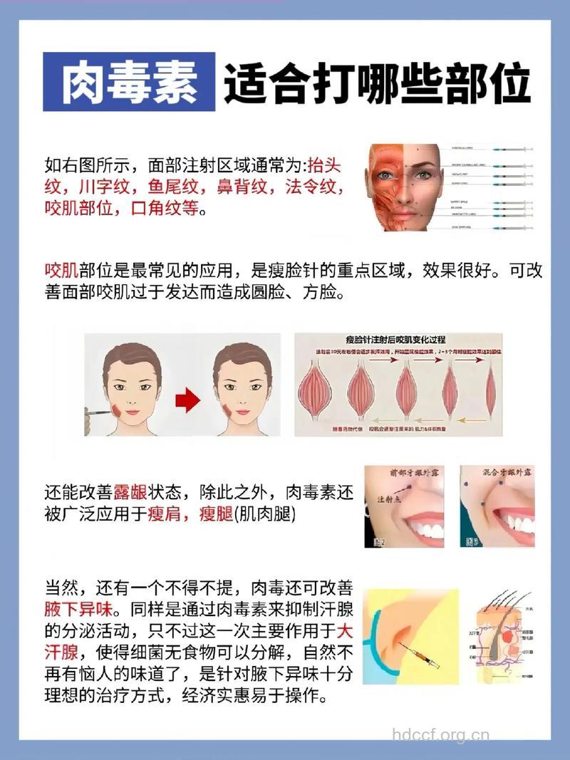 瘦脸针五大优势 让你不得不爱