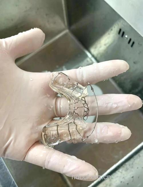 垫下巴术前的准备