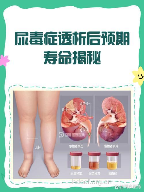 得了尿毒症还能活多久