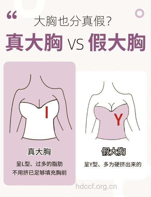 隆胸当道真假难辨?12招教你辨“真胸”