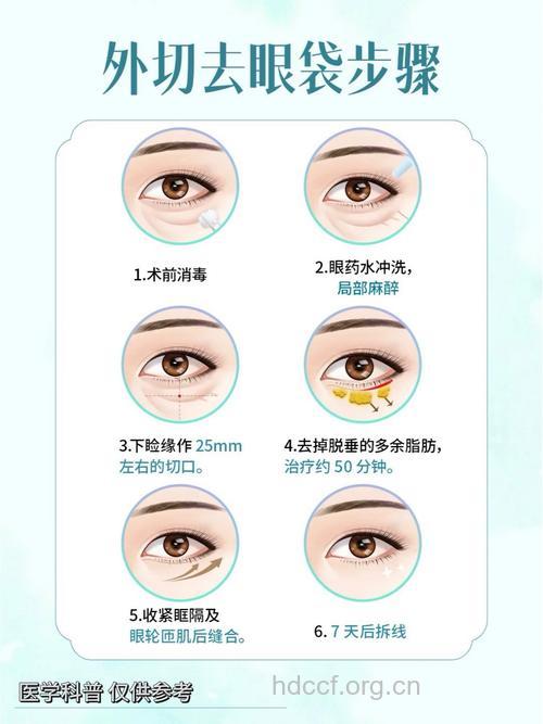 常见的5种祛眼袋手术方法