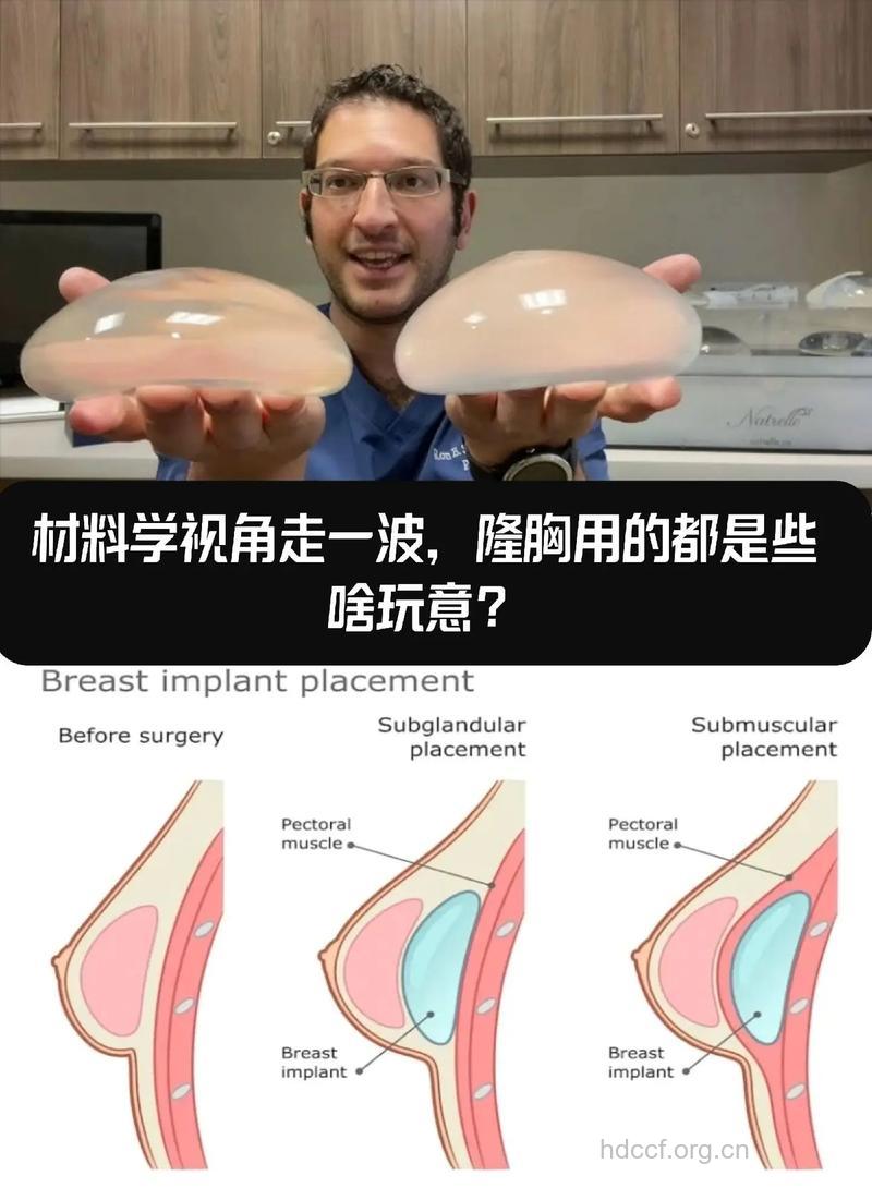 关于丰胸有哪些手术材料