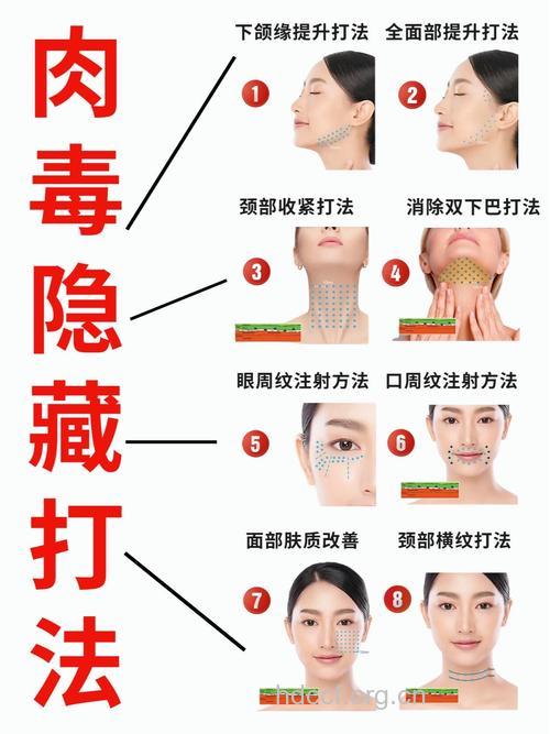 五类人不宜用肉毒素除皱