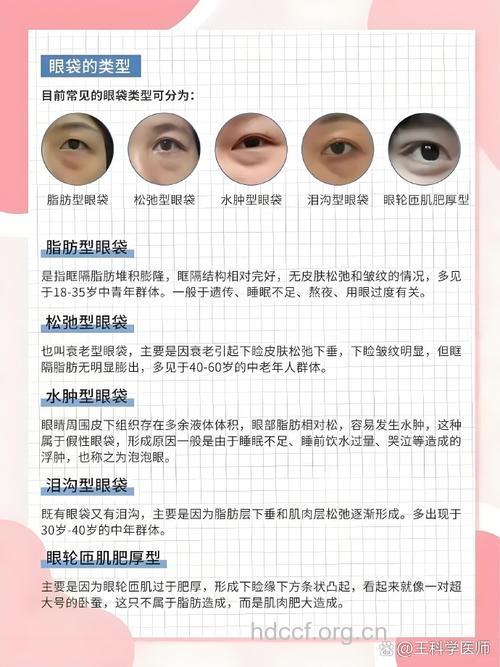 进行眼部整形有哪些常见问题