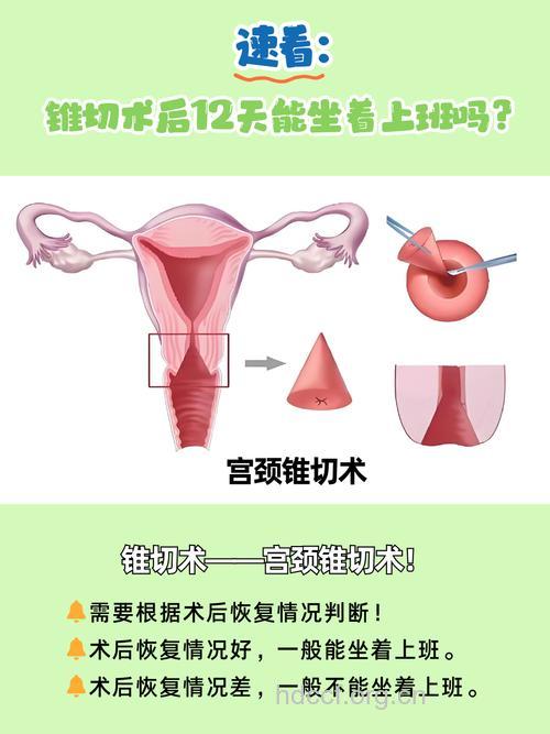 女性有哪些妇科整形方法