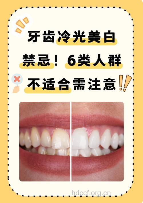 哪些人群不宜牙齿美白