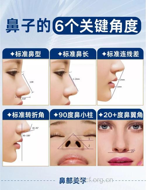 隆鼻整形的三大黄金线