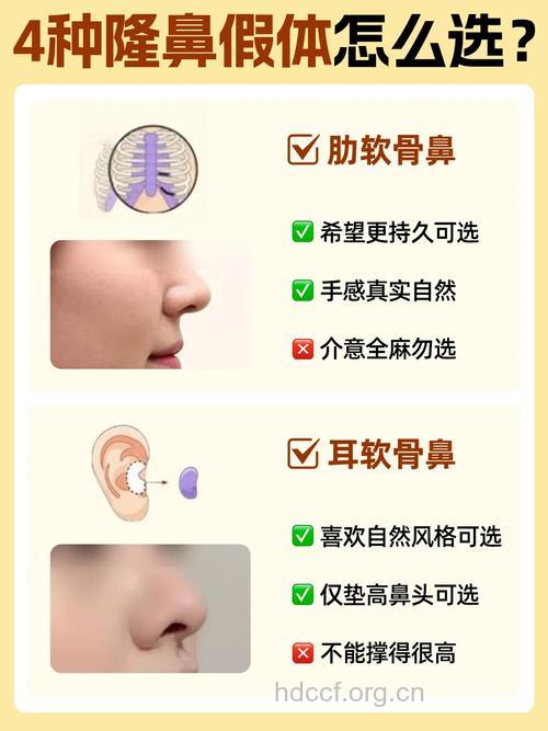 假体隆鼻特点 你知道哪些吗?