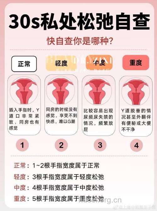 需要做生殖整形的7种情况